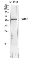 SSTR2 Polyclonal Antibody