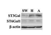 ST6GAL1 Polyclonal Antibody