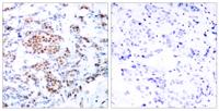 Stat5 Polyclonal Antibody