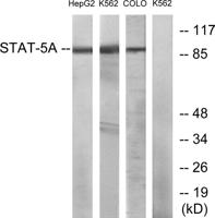 Stat5 Polyclonal Antibody