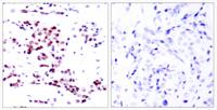 Stat5a Polyclonal Antibody