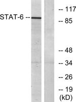 Stat6 Polyclonal Antibody