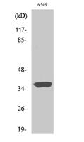 STEAP1 Polyclonal Antibody