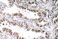 STEAP1 Polyclonal Antibody