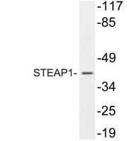 STEAP1 Polyclonal Antibody