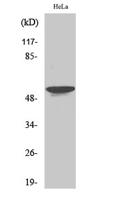 STK33 Polyclonal Antibody