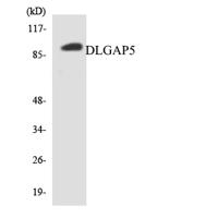 HURP Polyclonal Antibody