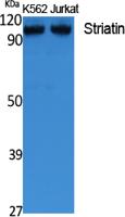 Striatin Polyclonal Antibody