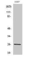 AQP2 Polyclonal Antibody