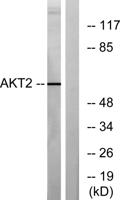 Akt2 Polyclonal Antibody