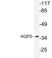 AQP5 Polyclonal Antibody