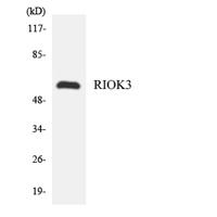 SUDD Polyclonal Antibody