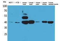 IDH3A Polyclonal Antibody