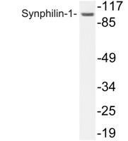 Synphilin-1 Polyclonal Antibody