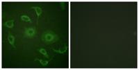 IFN-α/βRα Polyclonal Antibody