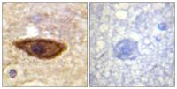 IFN-α/βRα Polyclonal Antibody