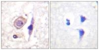 IFN-γRα Polyclonal Antibody