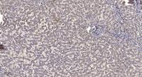 T2R1 Polyclonal Antibody