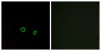 T2R10 Polyclonal Antibody