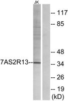 T2R13 Polyclonal Antibody