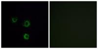 T2R14 Polyclonal Antibody