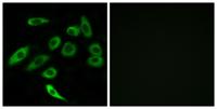 T2R3 Polyclonal Antibody