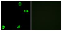 T2R39 Polyclonal Antibody