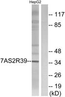 T2R39 Polyclonal Antibody