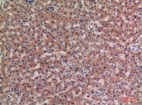 IGFBP1 Polyclonal Antibody