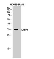 IGFBP3 Polyclonal Antibody