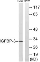 IGFBP3 Polyclonal Antibody