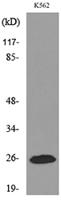 IGFBP6 Polyclonal Antibody