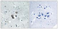 IGFBP7 Polyclonal Antibody