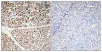 IGF-I Polyclonal Antibody