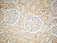 IGF-IR Polyclonal Antibody