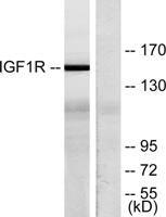 IGF-IR Polyclonal Antibody