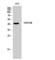 IGSF4B Polyclonal Antibody