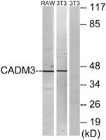 IGSF4B Polyclonal Antibody