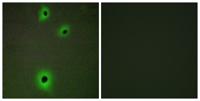 IGSF4C Polyclonal Antibody