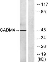 IGSF4C Polyclonal Antibody