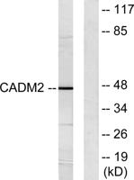 IGSF4D Polyclonal Antibody