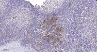 IGSF4D Polyclonal Antibody