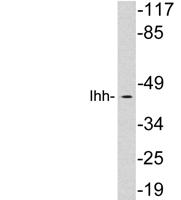 Ihh Polyclonal Antibody