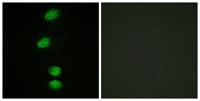 AR (phospho Ser94) Polyclonal Antibody