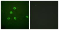 Fos B Polyclonal Antibody