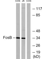 Fos B Polyclonal Antibody