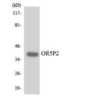 Olfactory receptor 5P2 Polyclonal Antibody