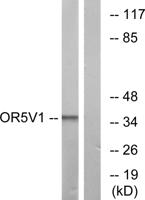 Olfactory receptor 5V1 Polyclonal Antibody