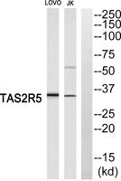 T2R5 Polyclonal Antibody