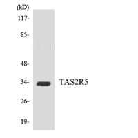 T2R5 Polyclonal Antibody